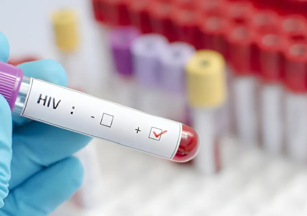 Kenya Advances HIV Prevention with WHO-Approved Lenacapavir Rollout